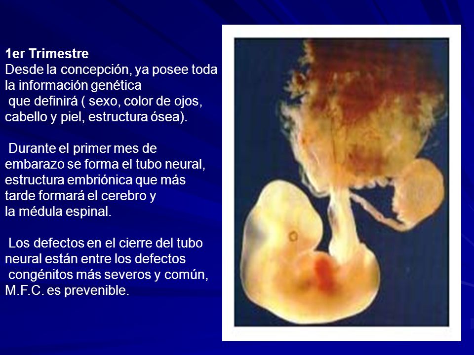 Proton el aceite para los cabellos